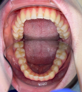 Zähne werden untersucht in Augsburg