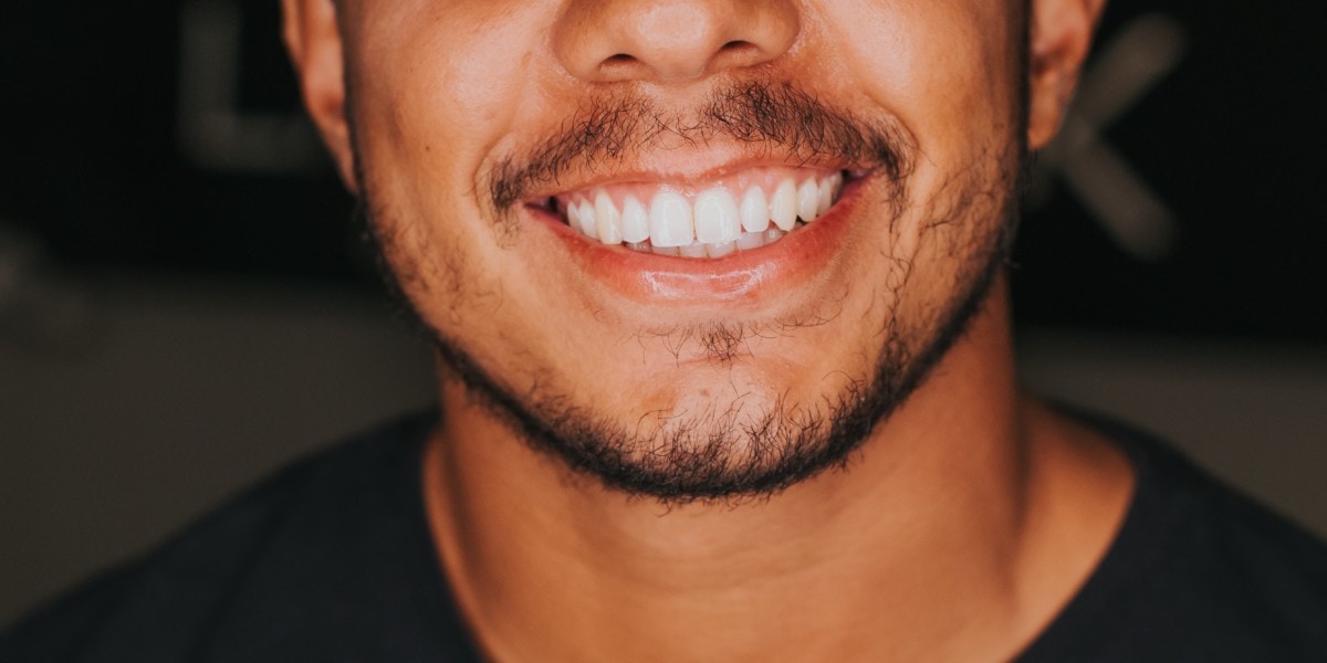 Mann mit schönen Zähnen
