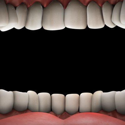 Zungenpressen: Wenn die Zunge immer wieder die Zähne verschiebt.