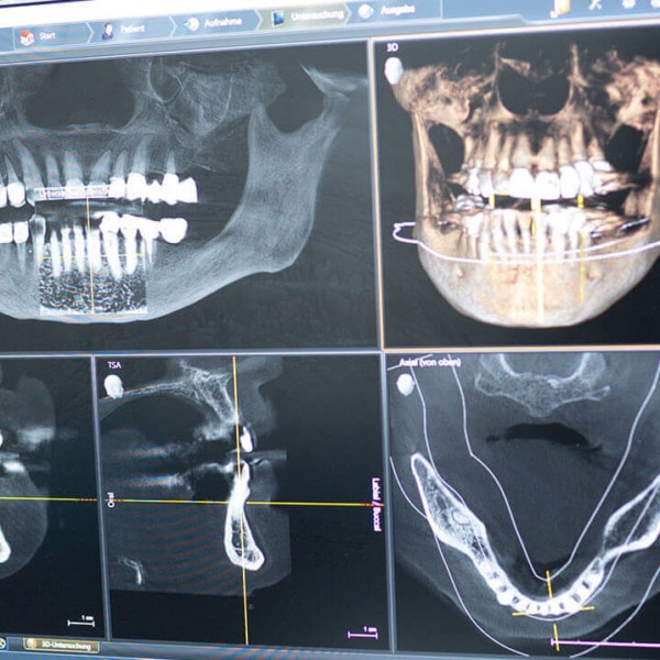 ärztliche Images von Zähnen und Kiefen auf einem Bildschirm