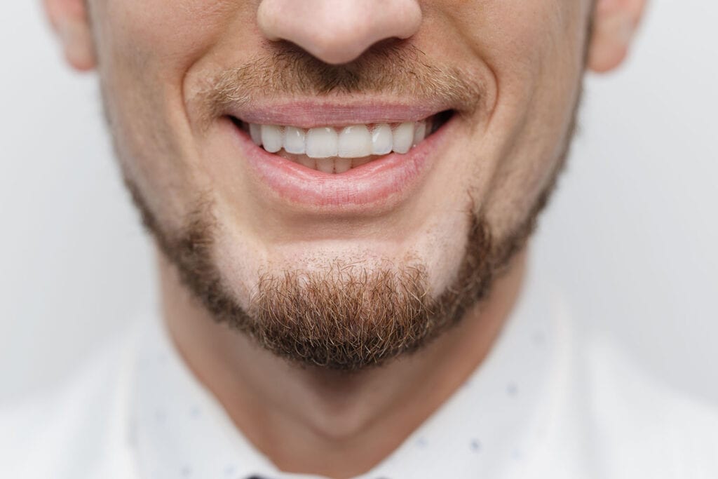 Nahaufnahme transparente Aligner im Mund beim Zahnarzt