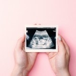 Retainer in der Schwangerschaft, Zahnreinigung Schwangerschaft