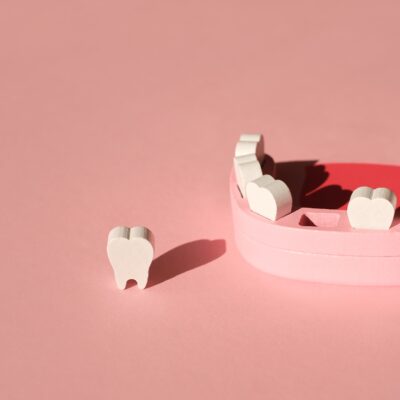 Die häufigsten Gründe für Zahnverlust